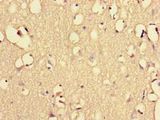 EHD3 Antibody - Immunohistochemistry of paraffin-embedded human brain tissue at dilution of 1:100