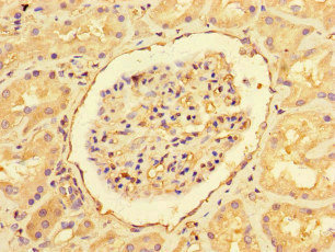 EHD3 Antibody - Immunohistochemistry of paraffin-embedded human kidney tissue at dilution of 1:100
