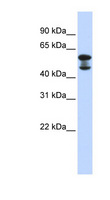 EHD4 Antibody - EHD4 antibody Western blot of Fetal Lung lysate. This image was taken for the unconjugated form of this product. Other forms have not been tested.