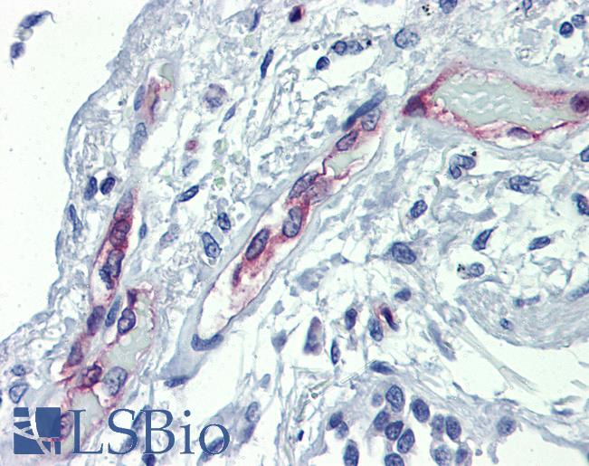 EHD4 Antibody - Anti-EHD4 antibody IHC of human lung. Immunohistochemistry of formalin-fixed, paraffin-embedded tissue after heat-induced antigen retrieval. Antibody concentration 5 ug/ml.  This image was taken for the unconjugated form of this product. Other forms have not been tested.
