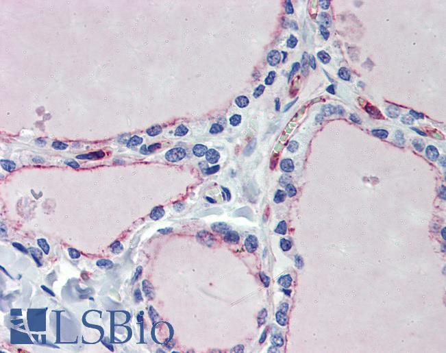 EHD4 Antibody - Anti-EHD4 antibody IHC of human thyroid. Immunohistochemistry of formalin-fixed, paraffin-embedded tissue after heat-induced antigen retrieval. Antibody concentration 5 ug/ml.  This image was taken for the unconjugated form of this product. Other forms have not been tested.