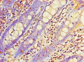 EHHADH / Enoyl-Coa Hydratase Antibody - Immunohistochemistry of paraffin-embedded human rectum tissue using antibody at 1:100 dilution.  This image was taken for the unconjugated form of this product. Other forms have not been tested.