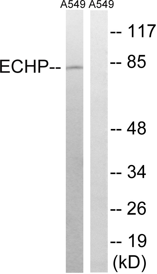 EHHADH / Enoyl-Coa Hydratase Antibody - Western blot analysis of lysates from A549 cells, using EHHADH Antibody. The lane on the right is blocked with the synthesized peptide.