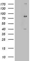 EHHADH / Enoyl-Coa Hydratase Antibody - HEK293T cells were transfected with the pCMV6-ENTRY control (Left lane) or pCMV6-ENTRY EHHADH (Right lane) cDNA for 48 hrs and lysed. Equivalent amounts of cell lysates (5 ug per lane) were separated by SDS-PAGE and immunoblotted with anti-EHHADH.
