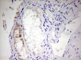 EHHADH / Enoyl-Coa Hydratase Antibody - IHC of paraffin-embedded Human Kidney tissue using anti-EHHADH mouse monoclonal antibody. (Heat-induced epitope retrieval by 10mM citric buffer, pH6.0, 120°C for 3min).