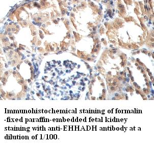 EHHADH / Enoyl-Coa Hydratase Antibody