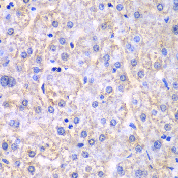 EHHADH / Enoyl-Coa Hydratase Antibody - Immunohistochemistry of paraffin-embedded human liver injury tissue.