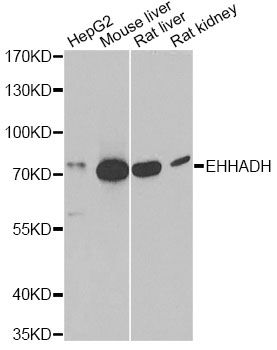 EHHADH / Enoyl-Coa Hydratase Antibody - Western blot analysis of extracts of various cell lines, using EHHADH antibody at 1:1000 dilution. The secondary antibody used was an HRP Goat Anti-Rabbit IgG (H+L) at 1:10000 dilution. Lysates were loaded 25ug per lane and 3% nonfat dry milk in TBST was used for blocking. An ECL Kit was used for detection and the exposure time was 90s.