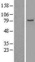 EHHADH / Enoyl-Coa Hydratase Protein - Western validation with an anti-DDK antibody * L: Control HEK293 lysate R: Over-expression lysate