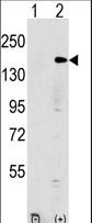EHMT1 Antibody - Western blot of EHMT1 (arrow) using rabbit polyclonal EHMT1 Antibody. 293 cell lysates (2 ug/lane) either nontransfected (Lane 1) or transiently transfected with the EHMT1 gene (Lane 2) (Origene Technologies).