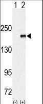 EHMT1 Antibody - Western blot of EUHMTASE (arrow) using rabbit polyclonal EHMT1 (EUHMTASE1) Antibody. 293 cell lysates (2 ug/lane) either nontransfected (Lane 1) or transiently transfected with the EUHMTASE gene (Lane 2) (Origene Technologies).