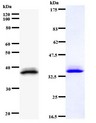 EHMT1 Antibody - Western blot of immunized recombinant protein using EHMT1 antibody. Left: EHMT1 staining. Right: Coomassie Blue staining of immunized recombinant protein.