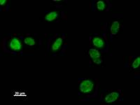 EHMT1 Antibody - Immunostaining analysis in HeLa cells. HeLa cells were fixed with 4% paraformaldehyde and permeabilized with 0.1% Triton X-100 in PBS. The cells were immunostained with anti-EHMT1 mAb.