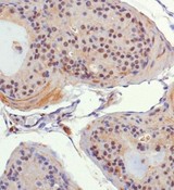EHMT1 Antibody - Immunohistochemistry: EHMT1 Antibody - IHC of EMHT1 in mouse prostate using DAB with hematoxylin counterstain.  This image was taken for the unconjugated form of this product. Other forms have not been tested.