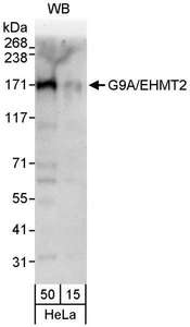 EHMT2 / G9A Antibody - Detection of Human G9A/EHMT2 by Western Blot. Sample: Whole cell lysate (15 and 50 ug) from HeLa cells. Antibody: Affinity purified rabbit anti-G9A/EHMT2 antibody used for WB at 1 ug/ml. Detection: Chemiluminescence with an exposure time of 30 seconds.