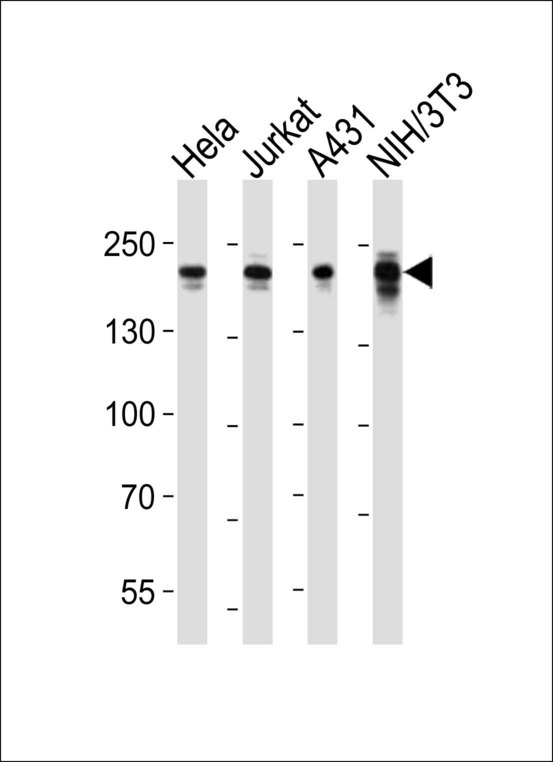 EHMT2 / G9A Antibody - Western blot of lysates from HeLa, Jurkat, A431, mouse NIH/3T3 cell line (from left to right), using EHMT2 antibody diluted at 1:1000 at each lane. A goat anti-rabbit IgG H&L (HRP) at 1:10000 dilution was used as the secondary antibody. Lysates at 20 ug per lane.