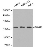 EHMT2 / G9A Antibody - Western blot of EHMT2 pAb in extracts from Jurkat, HEK-293 and Hela cells.