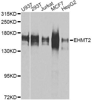 EHMT2 / G9A Antibody - Western blot analysis of extracts of various cell lines, using EHMT2 antibody at 1:1000 dilution. The secondary antibody used was an HRP Goat Anti-Rabbit IgG (H+L) at 1:10000 dilution. Lysates were loaded 25ug per lane and 3% nonfat dry milk in TBST was used for blocking. An ECL Kit was used for detection and the exposure time was 30s.