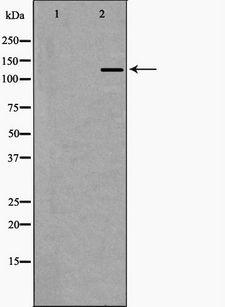 EHMT2 / G9A Antibody - Western blot analysis of HeLa whole cells lysates using EHMT2 antibody. The lane on the left is treated with the antigen-specific peptide.
