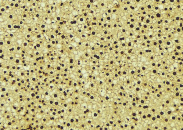 EHMT2 / G9A Antibody - 1:100 staining mouse liver tissue by IHC-P. The sample was formaldehyde fixed and a heat mediated antigen retrieval step in citrate buffer was performed. The sample was then blocked and incubated with the antibody for 1.5 hours at 22°C. An HRP conjugated goat anti-rabbit antibody was used as the secondary.