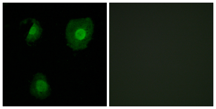 EID1 / EID-1 Antibody - Immunofluorescence analysis of A549 cells, using EID1 Antibody. The picture on the right is blocked with the synthesized peptide.