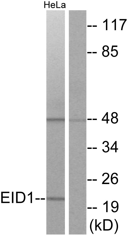 EID1 / EID-1 Antibody - Western blot analysis of lysates from HeLa cells, using EID1 Antibody. The lane on the right is blocked with the synthesized peptide.
