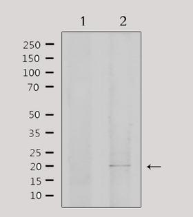 EID1 / EID-1 Antibody - Western blot analysis of extracts of 293 cells using EID1 antibody. Lane 1 was treated with the antigen-specific peptide.