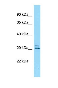 EID2 Antibody - Eid2 antibody Western blot of Mouse Kidney lysate. Antibody concentration 1 ug/ml.  This image was taken for the unconjugated form of this product. Other forms have not been tested.
