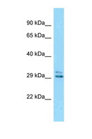 EID2 Antibody - Eid2 antibody Western blot of Mouse Kidney lysate. Antibody concentration 1 ug/ml.  This image was taken for the unconjugated form of this product. Other forms have not been tested.