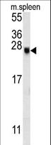 EID2 Antibody - EID2 Antibody western blot of mouse spleen tissue lysates (15 ug/lane). The EID2 antibody detected EID2 protein (arrow).