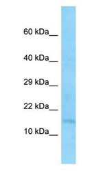 EIF1 Antibody - EIF1 antibody Western Blot of MCF7 cell lysate.  This image was taken for the unconjugated form of this product. Other forms have not been tested.
