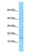 EIF1 Antibody - EIF1 antibody Western Blot of MCF7 cell lysate.  This image was taken for the unconjugated form of this product. Other forms have not been tested.