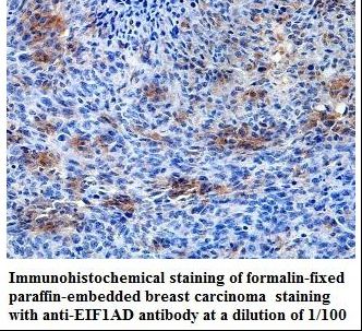 EIF1AD Antibody