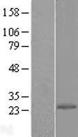 EIF1AD Protein - Western validation with an anti-DDK antibody * L: Control HEK293 lysate R: Over-expression lysate