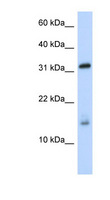 EIF1AX Antibody - EIF1AX antibody Western blot of Fetal Brain lysate. This image was taken for the unconjugated form of this product. Other forms have not been tested.