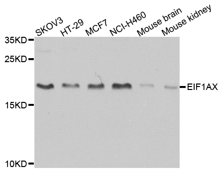 EIF1AX Antibody - Western blot analysis of extracts of various cell lines.