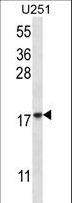 EIF1AY Antibody - EIF1AY Antibody western blot of U251 cell line lysates (35 ug/lane). The EIF1AY antibody detected the EIF1AY protein (arrow).