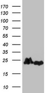 EIF1AY Antibody - HEK293T cells were transfected with the pCMV6-ENTRY control (Left lane) or pCMV6-ENTRY EIF1AY (Right lane) cDNA for 48 hrs and lysed. Equivalent amounts of cell lysates (5 ug per lane) were separated by SDS-PAGE and immunoblotted with anti-EIF1AY.