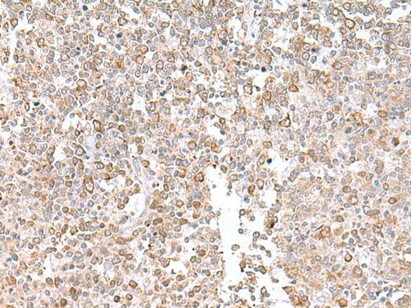 EIF1AY Antibody - Immunohistochemistry of paraffin-embedded Human tonsil tissue  using EIF1AY Polyclonal Antibody at dilution of 1:55(×200)