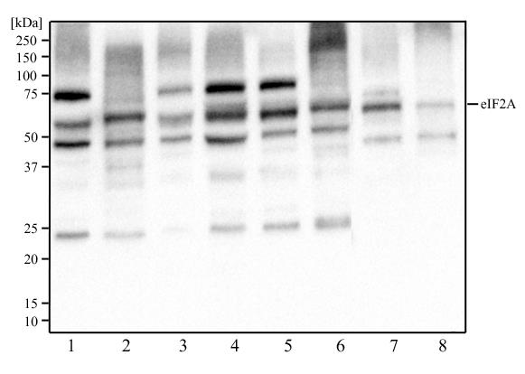 EIF2A / EIF2 Alpha Antibody - Western Blot: eIF2A Antibody (3A7B11) - Western blot analysis of HeLa (1), NIH3T3 (2), A431 (3), MCF-7 (4), Ntera2 (5), PC12 (6), HepG2 (7), and Cos7 (8) cell lysate using eIF2A antibody at a concentration of 2 ug/ml.