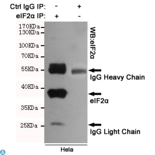 EIF2A / EIF2 Alpha Antibody - Immunoprecipitation analysis of Hela cell lysates using eIF2a.