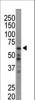 EIF2AK1 Antibody - Western blot of anti-HRI antibody in A375 cell lysate. HRI (arrow) was detected using purified antibody. Secondary HRP-anti-rabbit was used for signal visualization with chemiluminescence.