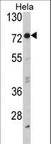 EIF2AK1 Antibody - Western blot of EIF2AK1 Antibody in HeLa cell line lysates (35 ug/lane). EIF2AK1 (arrow) was detected using the purified antibody.