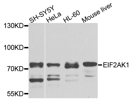 EIF2AK1 Antibody - Western blot analysis of extracts of various cells.