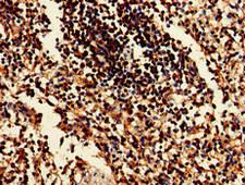 EIF2AK1 Antibody - Immunohistochemistry of paraffin-embedded human spleen tissue at dilution of 1:100