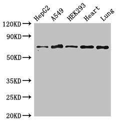 EIF2AK1 Antibody - Western Blot Positive WB detected in:HepG2 whole cell lysate,A549 whole cell lysate,HEK293 whole cell lysate,Rat heart tissue,Rat lung tissue All Lanes:EIF2AK1 antibody at 3µg/ml Secondary Goat polyclonal to rabbit IgG at 1/50000 dilution Predicted band size: 72 KDa Observed band size: 72 KDa