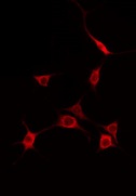 EIF2AK1 Antibody - Staining A549 cells by IF/ICC. The samples were fixed with PFA and permeabilized in 0.1% Triton X-100, then blocked in 10% serum for 45 min at 25°C. The primary antibody was diluted at 1:200 and incubated with the sample for 1 hour at 37°C. An Alexa Fluor 594 conjugated goat anti-rabbit IgG (H+L) Ab, diluted at 1/600, was used as the secondary antibody.
