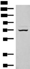 EIF2AK1 Antibody - Western blot analysis of 293T cell lysate  using EIF2AK1 Polyclonal Antibody at dilution of 1:350