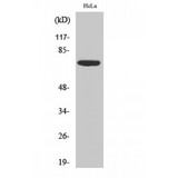 EIF2AK2 / PKR Antibody - Western blot of PKR antibody