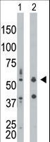 EIF2AK2 / PKR Antibody - The anti-PRKR antibody is used in Western blot to detect PRKR in mouse liver tissue lysate (Lane 1) and HepG2 cell lysate (Lane 2).